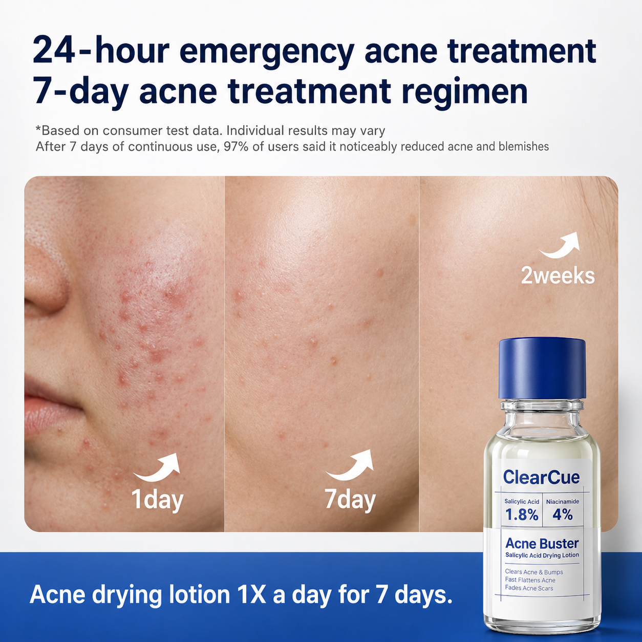 Before and after — skin clarity