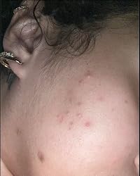 Customer result photo 2 from paige