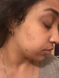 Customer result photo 3 from paige